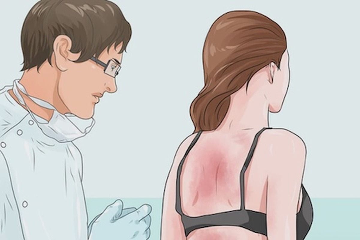 Visita dermatologica per una chiazza di pelle arrossata sulla schiena