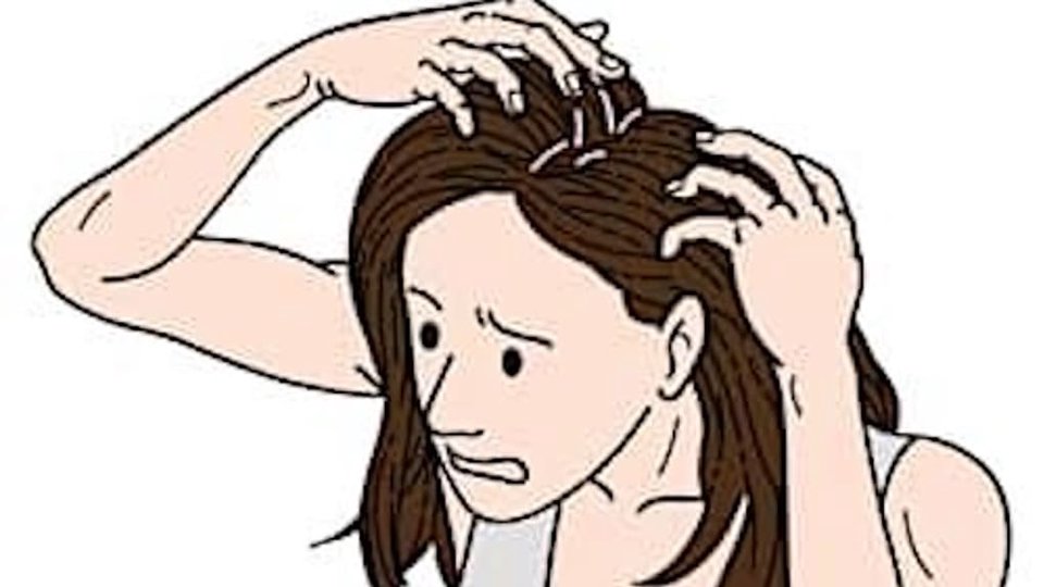 Donna che si massaggia il cuoio capelluto a causa del prurito